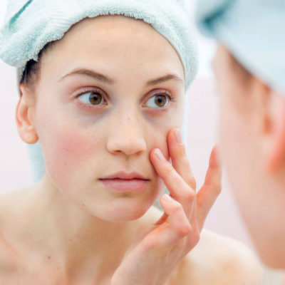 5 Tips For Taking Care Of Your Skin