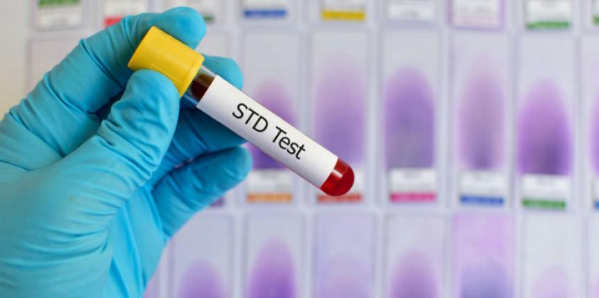 STD Tests