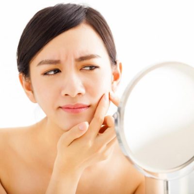 Skin Acne Symptoms, Causes And Acne Treatment In London