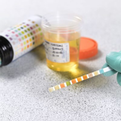 Drug Test Equipments